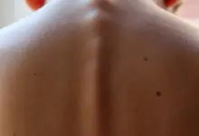 Pontada nas costas