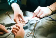 Qual é o valor de uma cirurgia de hérnia de disco