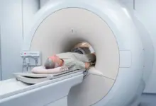 Tomografia da coluna lombar para hérnia de disco