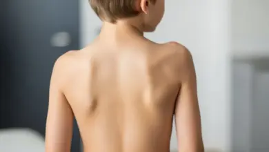 Escoliose congênita