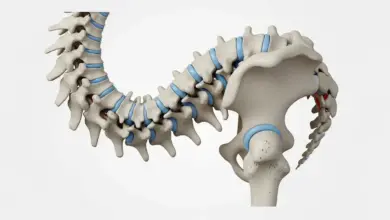 Escoliose pode matar