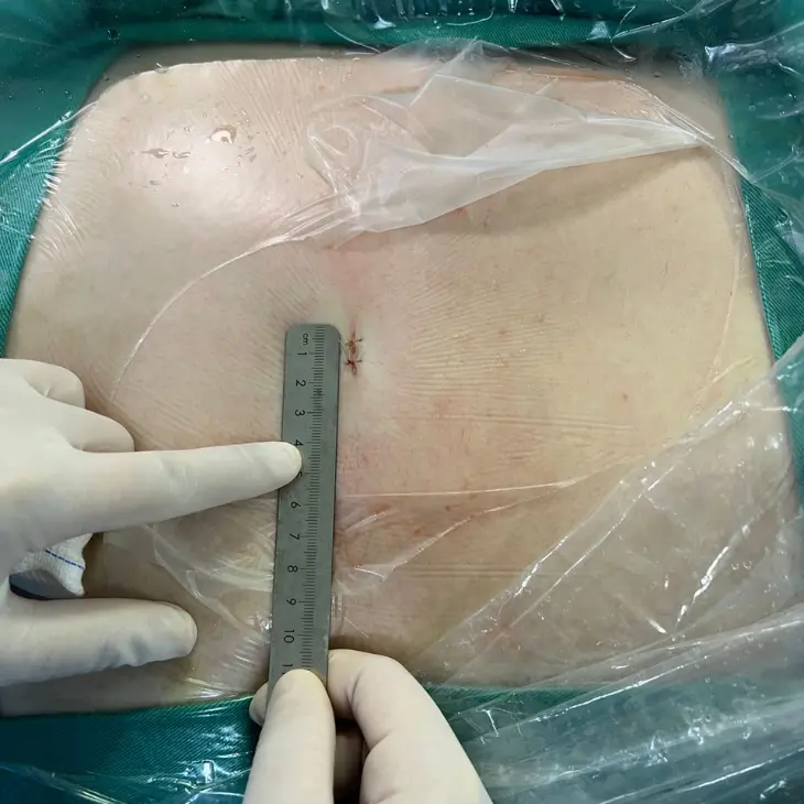 Hérnia de disco - anatomia e estrutura da coluna vertebral