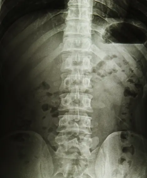 Ortopedista especialista em infiltração guiada por ultrassom na coluna em Goiânia