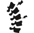 Artroplastia