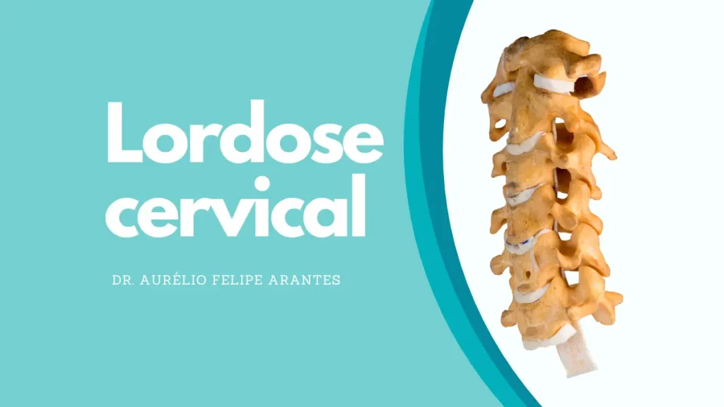 Lordose Cervical Confira As Principais Causas E Tratamentos